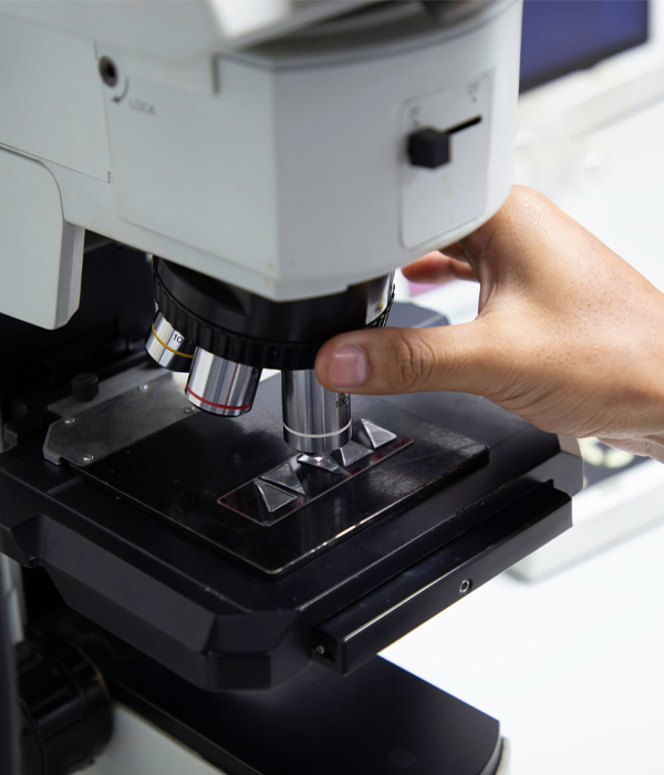 Analisi Metallografiche